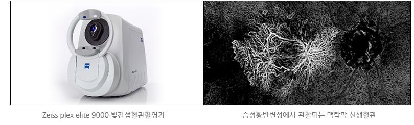Zeiss plex elite 9000 ºû°£¼·Ç÷°üÃÔ¿µ±â / ½À¼ºÈ²¹Ýº¯¼º¿¡¼ °üÂûµÇ´Â ¸Æ¶ô¸· ½Å»ýÇ÷°ü